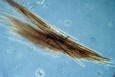 A microscopic image of blue green aglae